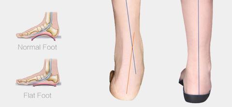 Premium Orthopedic Insoles